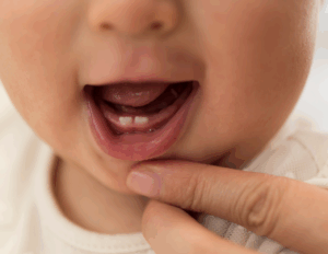 Looking after your baby’s teeth